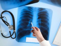 Жамбыл облысында туберкулезге шалдыққан науқастардың әлеуметтік жәрдемақылары төленбеген