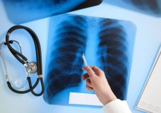 Жамбыл облысында туберкулезге шалдыққан науқастардың әлеуметтік жәрдемақылары төленбеген